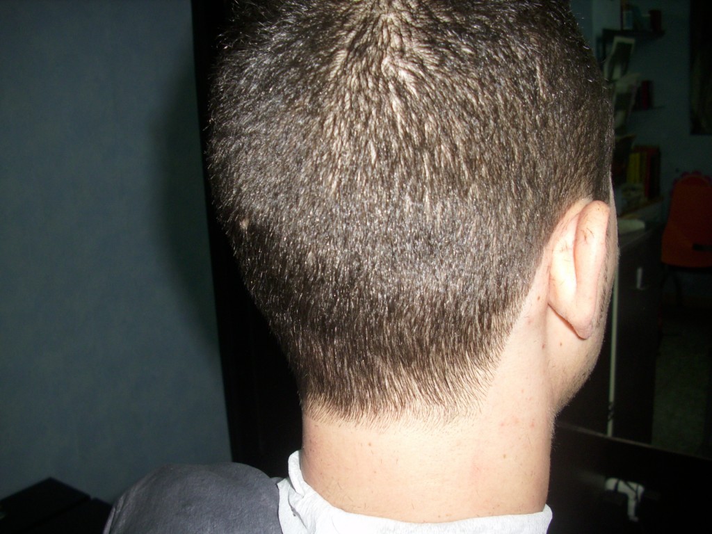 Recorte de cuello