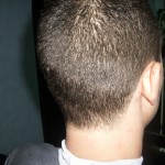 Recorte de cuello