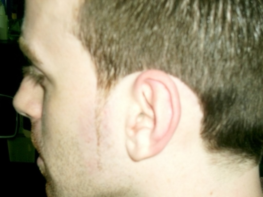 Detalle corte de pelo